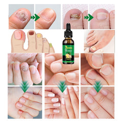 IMOLL Tratamiento de uñas con jengibre: aplicación en cutícula para nutrir.