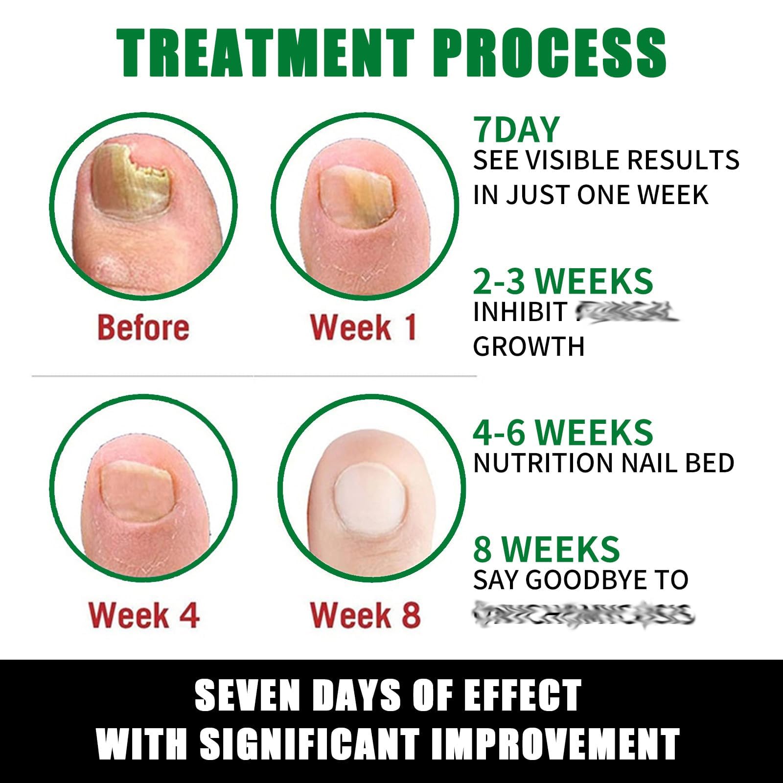 IMOLL Tratamiento de uñas con jengibre para nutrición diaria de la cutícula.