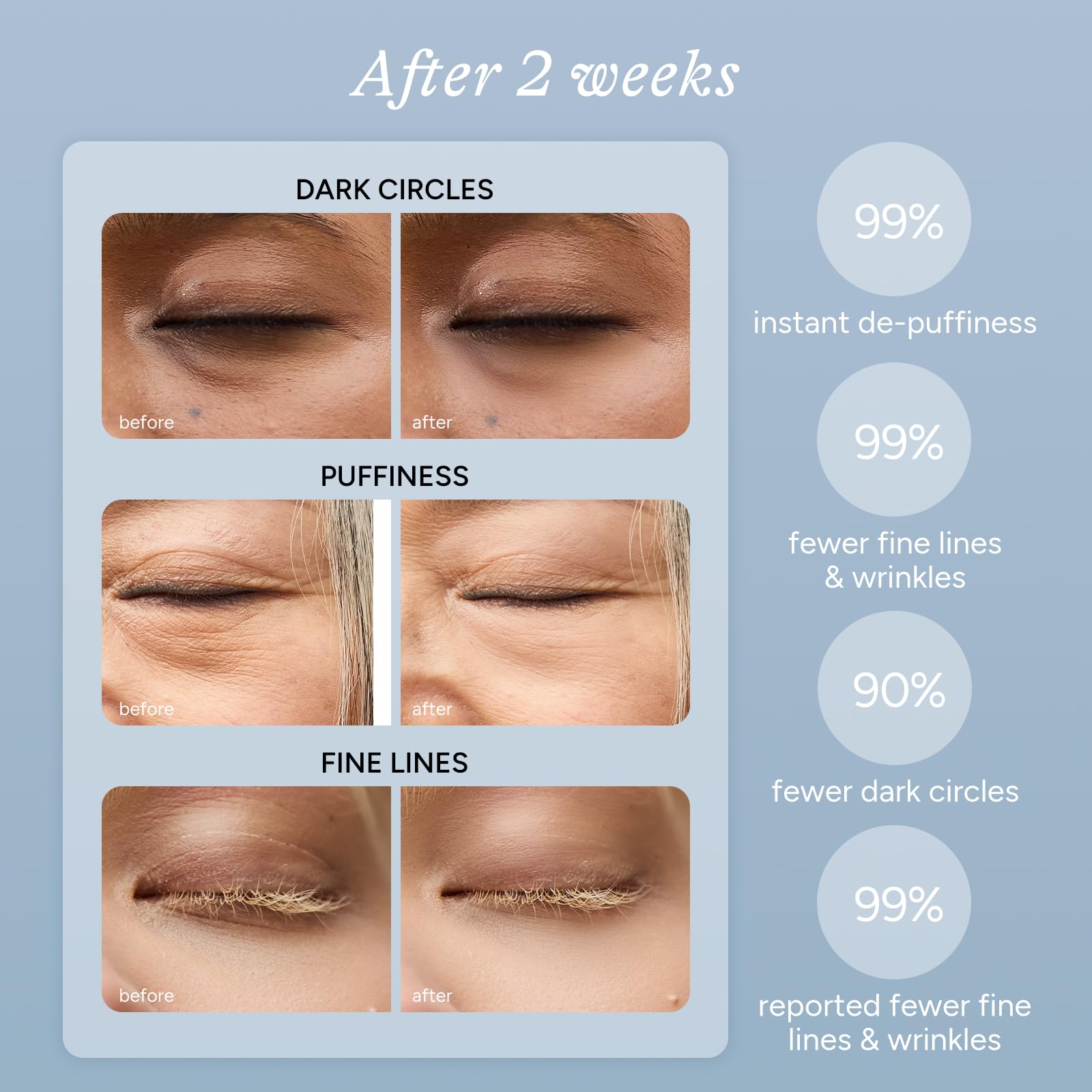 Parche de ojos In My Eyes con enfriamiento suave para deshinchar el contorno