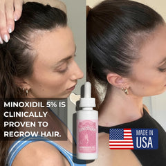 Innerbloom Minoxidil 5% para mujeres, aplicación de gotas en cabello para zonas de adelgazamiento.