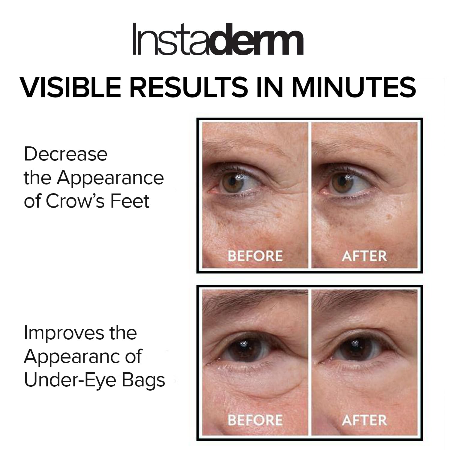 Instaderm bolsas-ojos-reduccion: posible alivio rápido