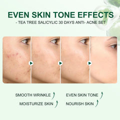 IREV serum con arbol de te para hidratación ligera