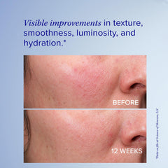 Aplicación en rostro para un tono más uniforme con Retinol+ Emulsion 0.3