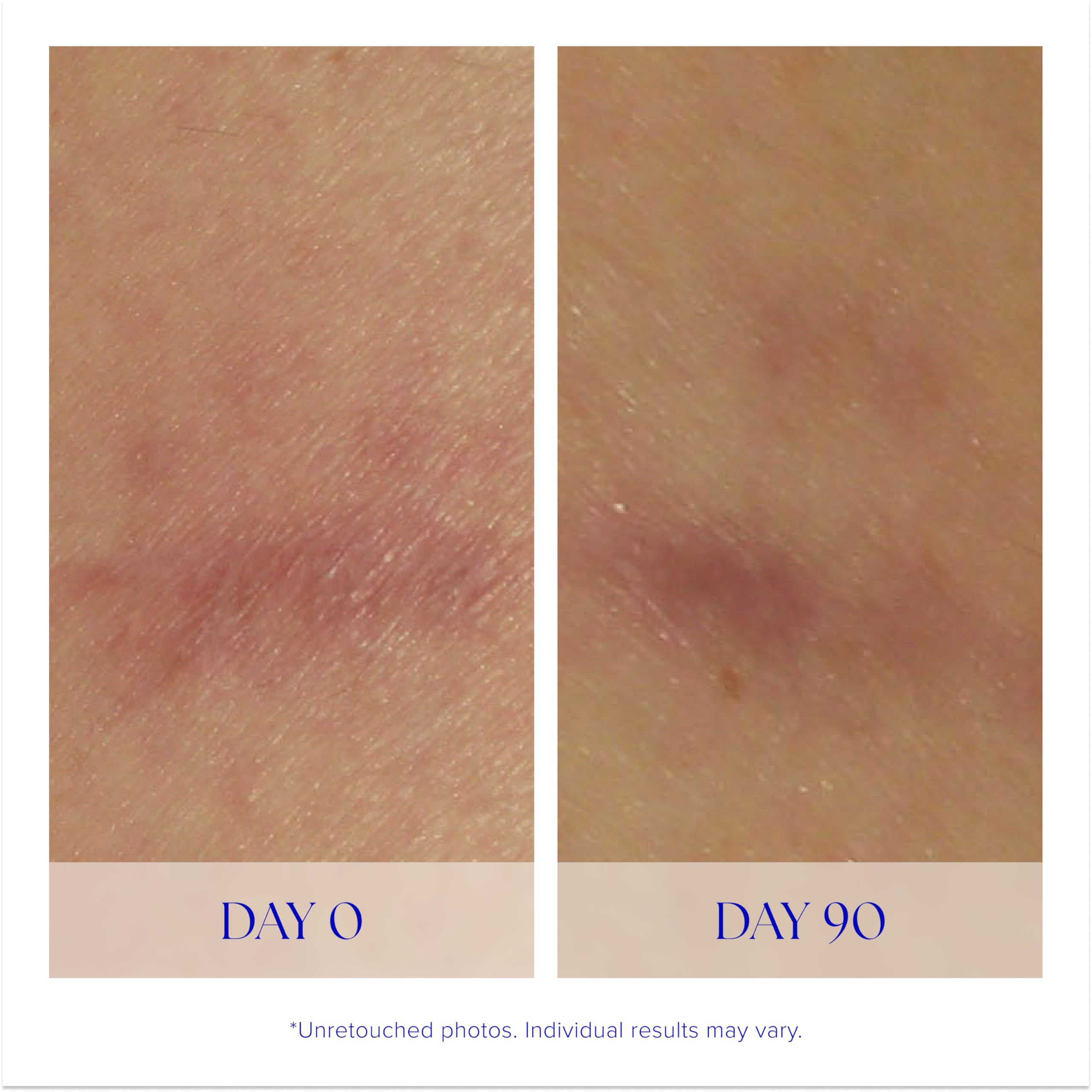 iS CLINICAL Super Serum Advance+ aplicación facial con dedos para absorción suave