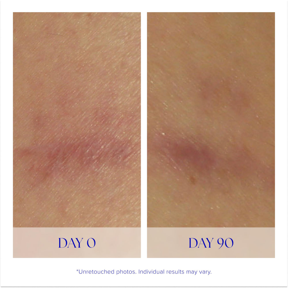 iS CLINICAL Super Serum Advance+ aplicación facial con dedos para absorción suave