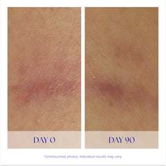 iS CLINICAL Super Serum Advance+ aplicación facial con dedos para absorción suave