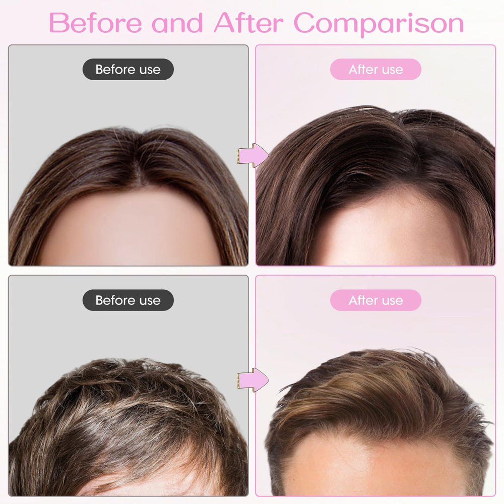 JANFUN pinzas volumen cabello aptas para distintos tipos de pelo