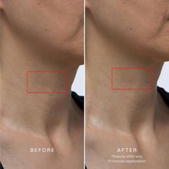 Karuna mascarilla hidrogel aplicación fría para pieles sensibles y frescura
