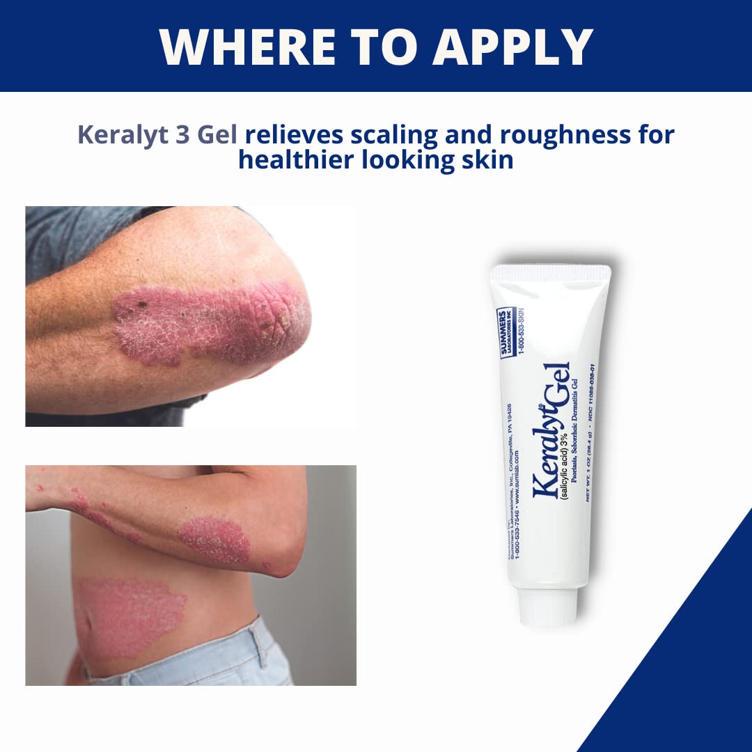 Keralyt 3% gel facilita la aplicación en zonas pequeñas.
