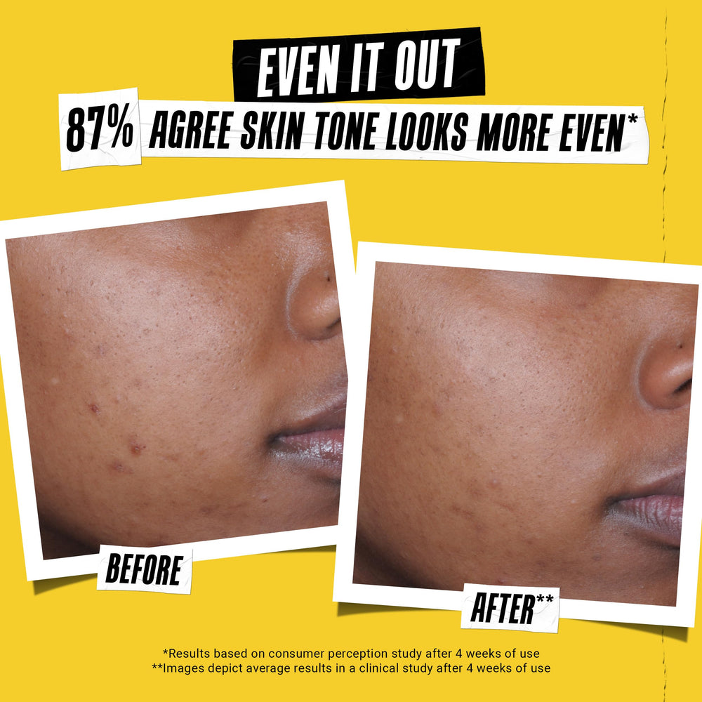 Kiehl's Better Screen UV Serum suits sensitive and acne-prone skin.