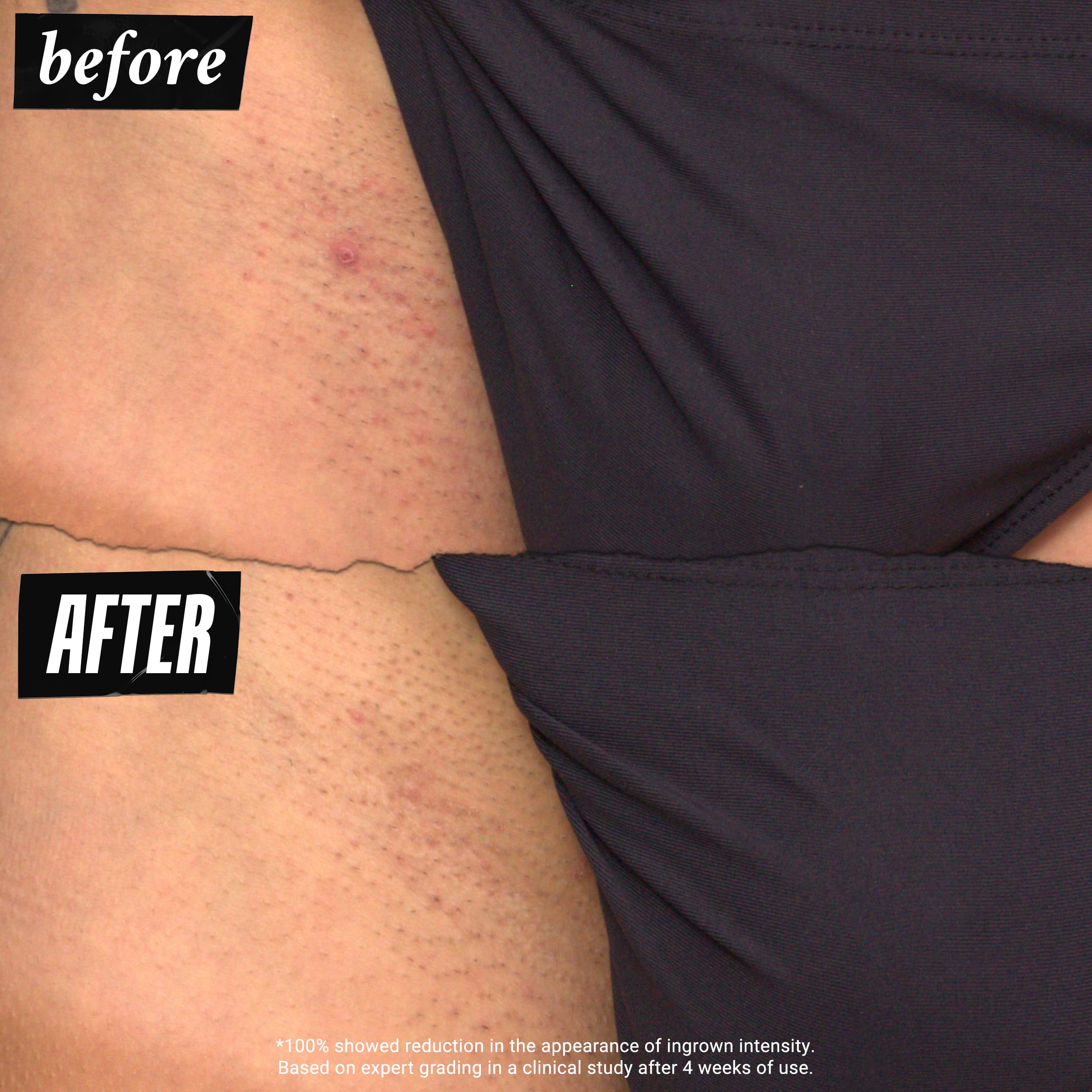 Kiehl's Textura ligera se absorbe rapidamente tras aplicar.