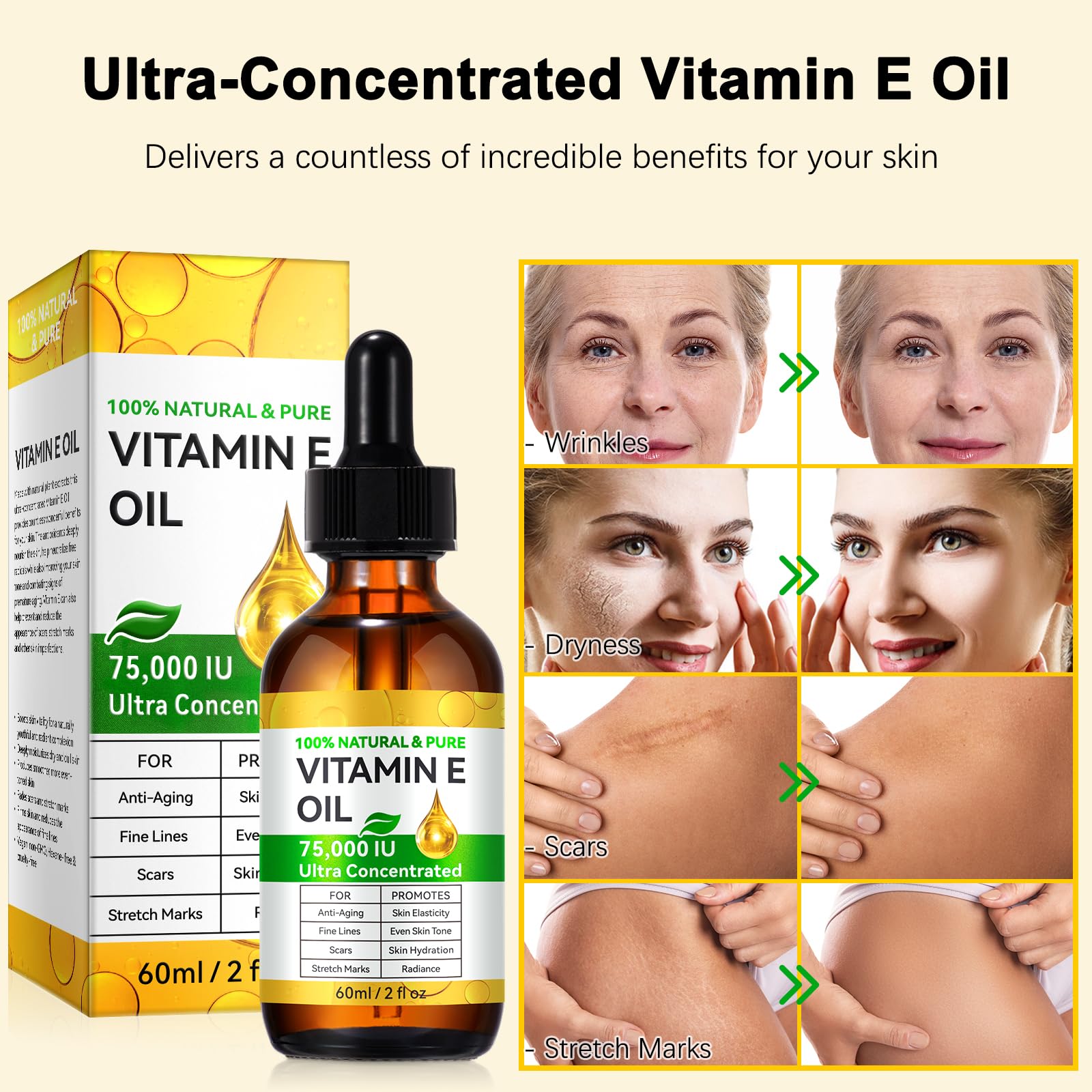 KITNOBLIS Aceite Vitamina E, gotas; suaviza cicatrices y estrías.