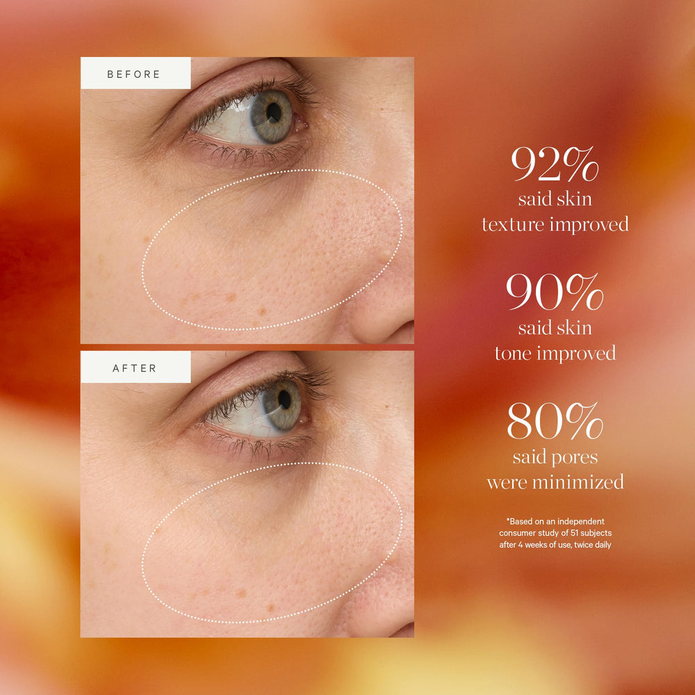 KORA Organics Turmeric Glow Drops ayuda a minimizar la apariencia de poros