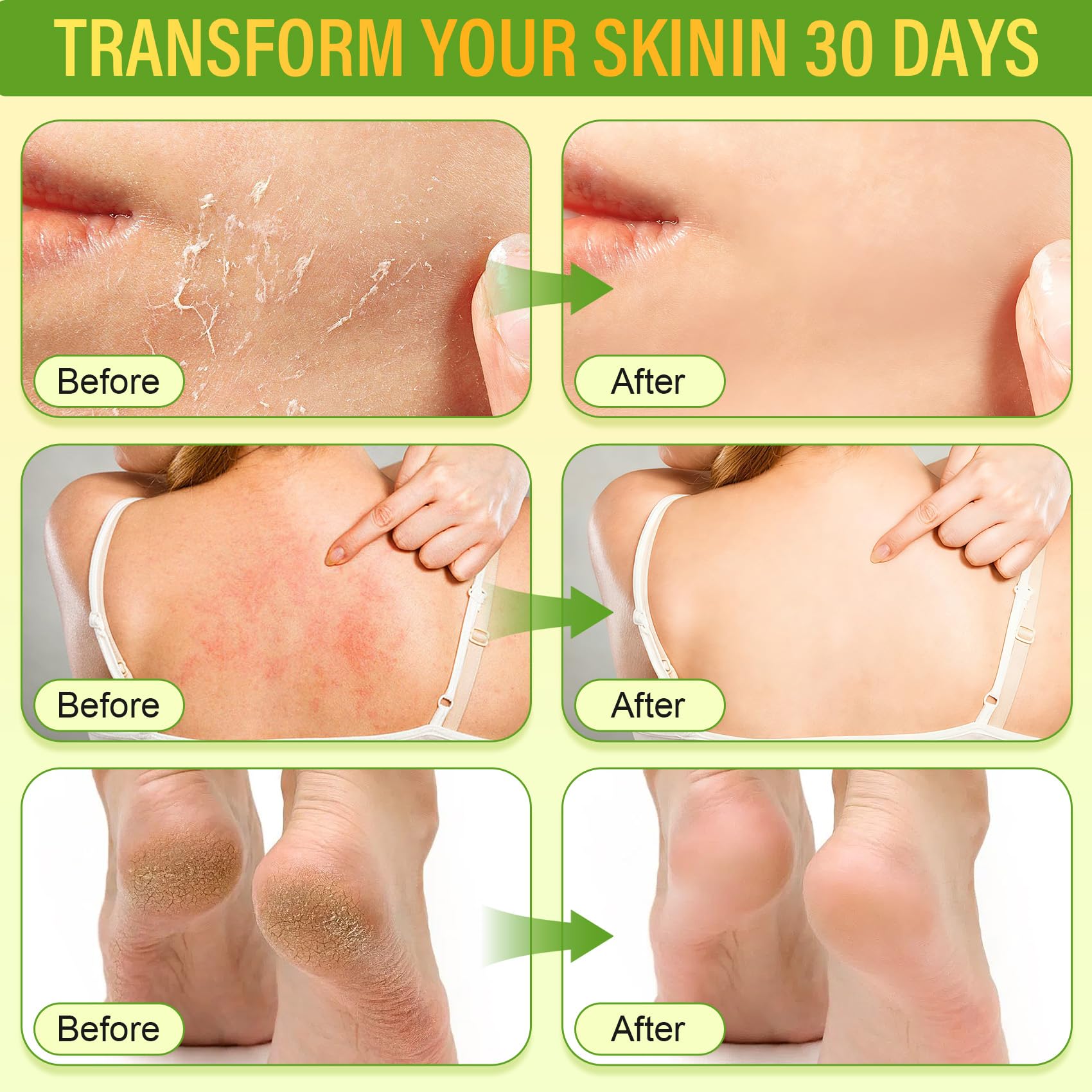 Laityum miel de manuka natural, nutrición suave para piel sensible.