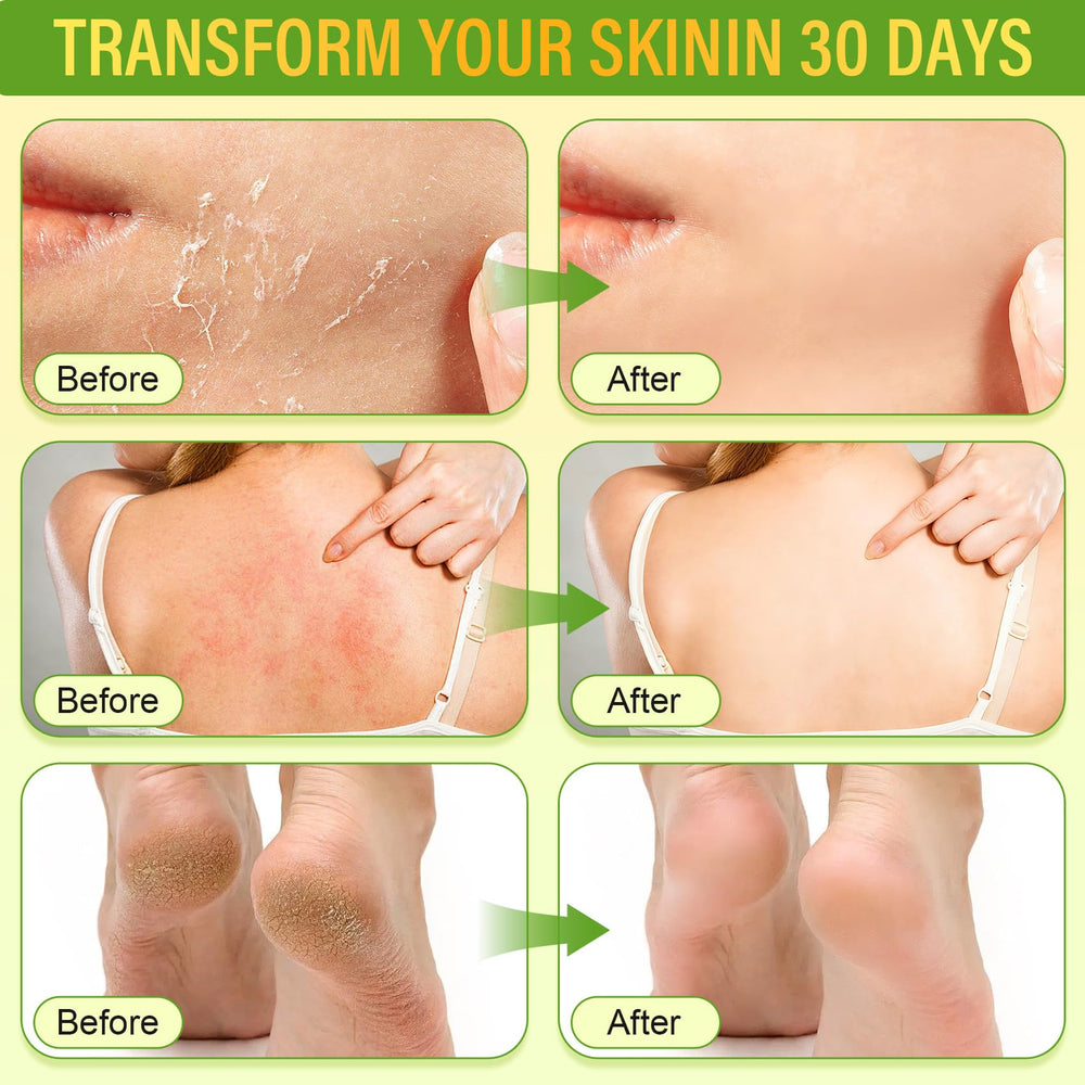 Laityum miel de manuka natural, nutrición suave para piel sensible.