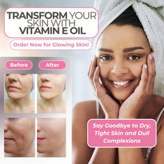 Leven Rose para cabello y uñas, cuidado nutritivo con vitamina E.