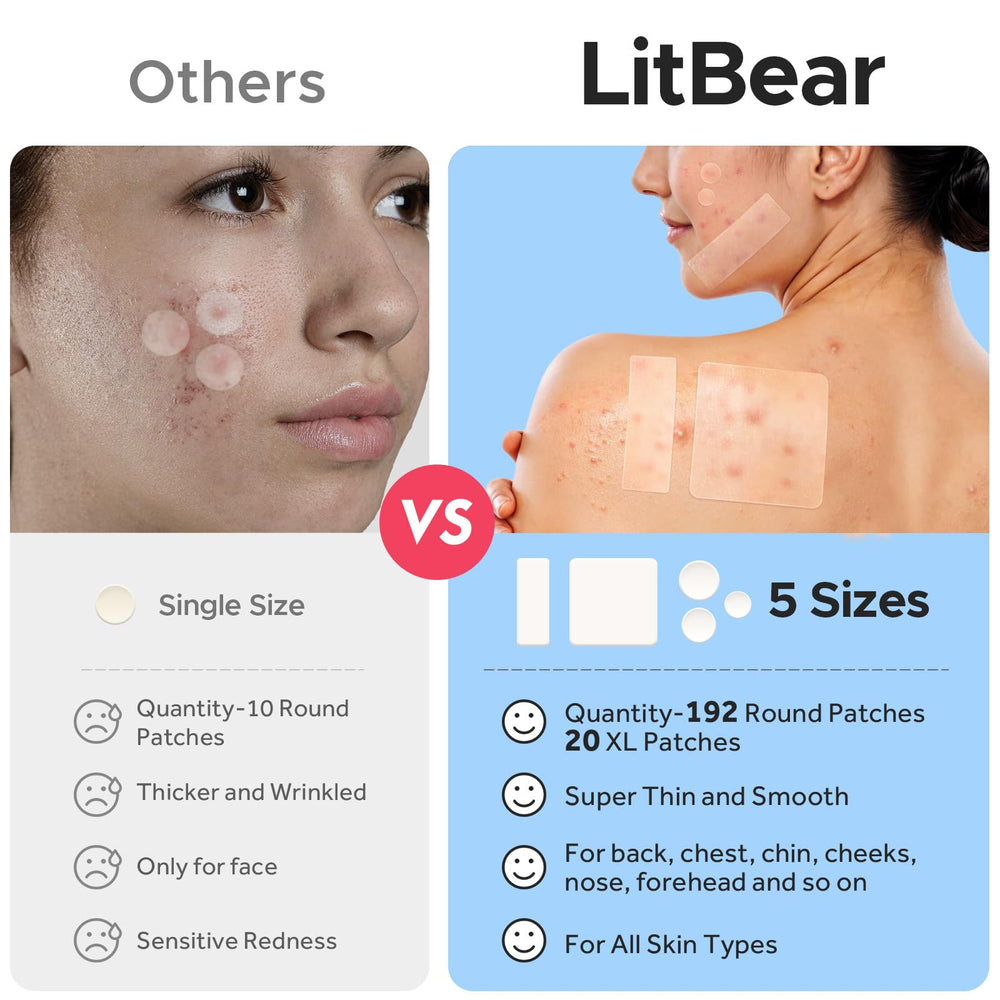 LitBear paquete 212 parches, variedad para tamaños diferentes
