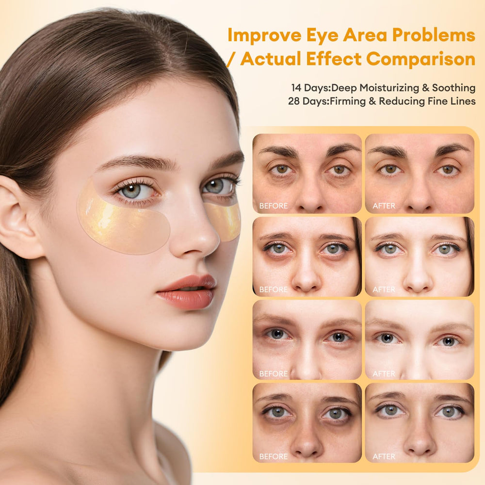 Parches de hidrogel LJ KuKu Lady con brillo dorado para iluminar la mirada.