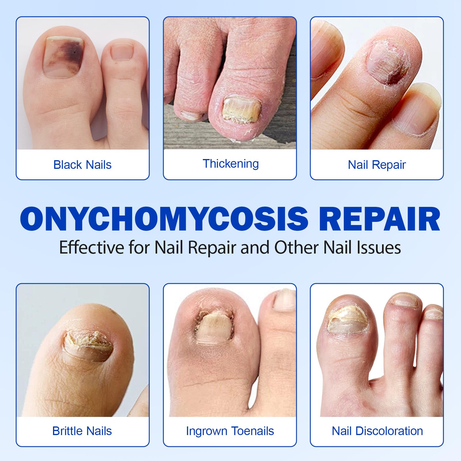 LTQXGT Fungal Nail Patches application steps showing quick at-home use.