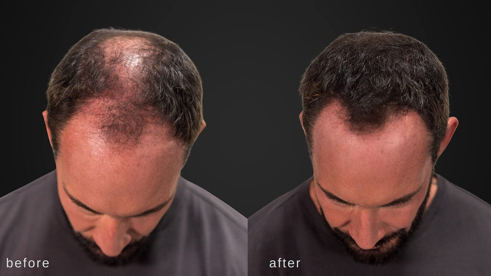 LUXE Professional secado con secador sin perder volumen.