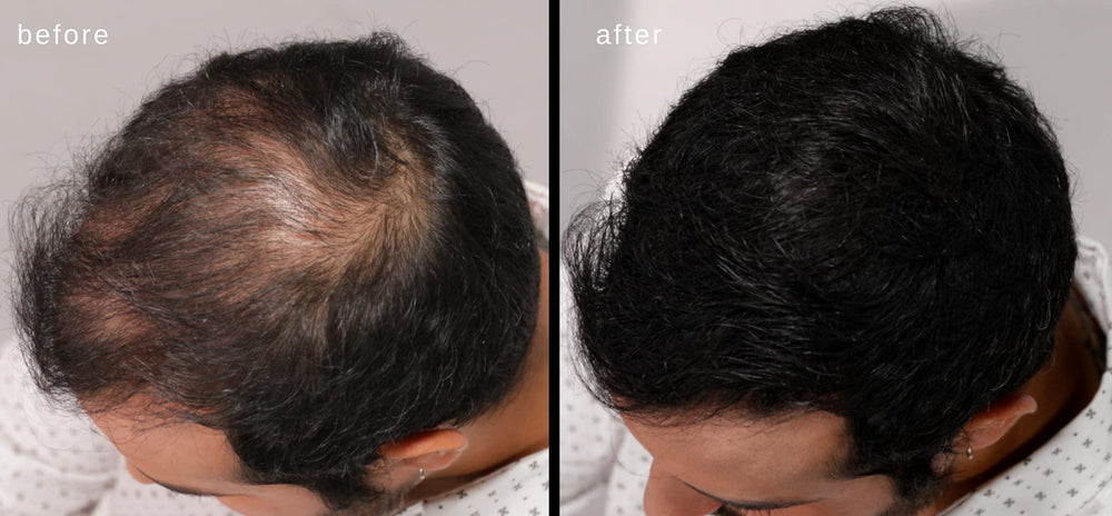 LUXE Professional prueba dermatológica y segura para la piel.