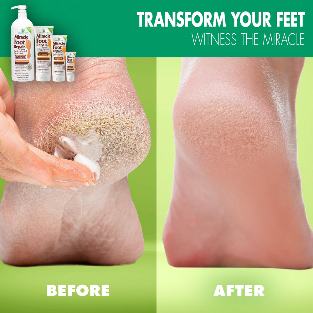 Miracle de Aloe aplicación en pies, masaje suave para hidratación diaria.
