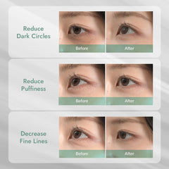 MIZON Cicaluronic ilumina la zona inferior con Vitamina K3 para aclarar ojeras.