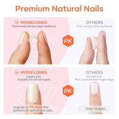 Modelones adhesivos gelatinosos para fijación sin esmalte