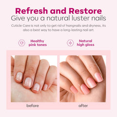 Modelones remover cutículas líquido: disuelve cutículas rápidamente para uñas limpias
