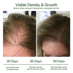Morovan: resultados posibles en 30 días para cabello más abundante.