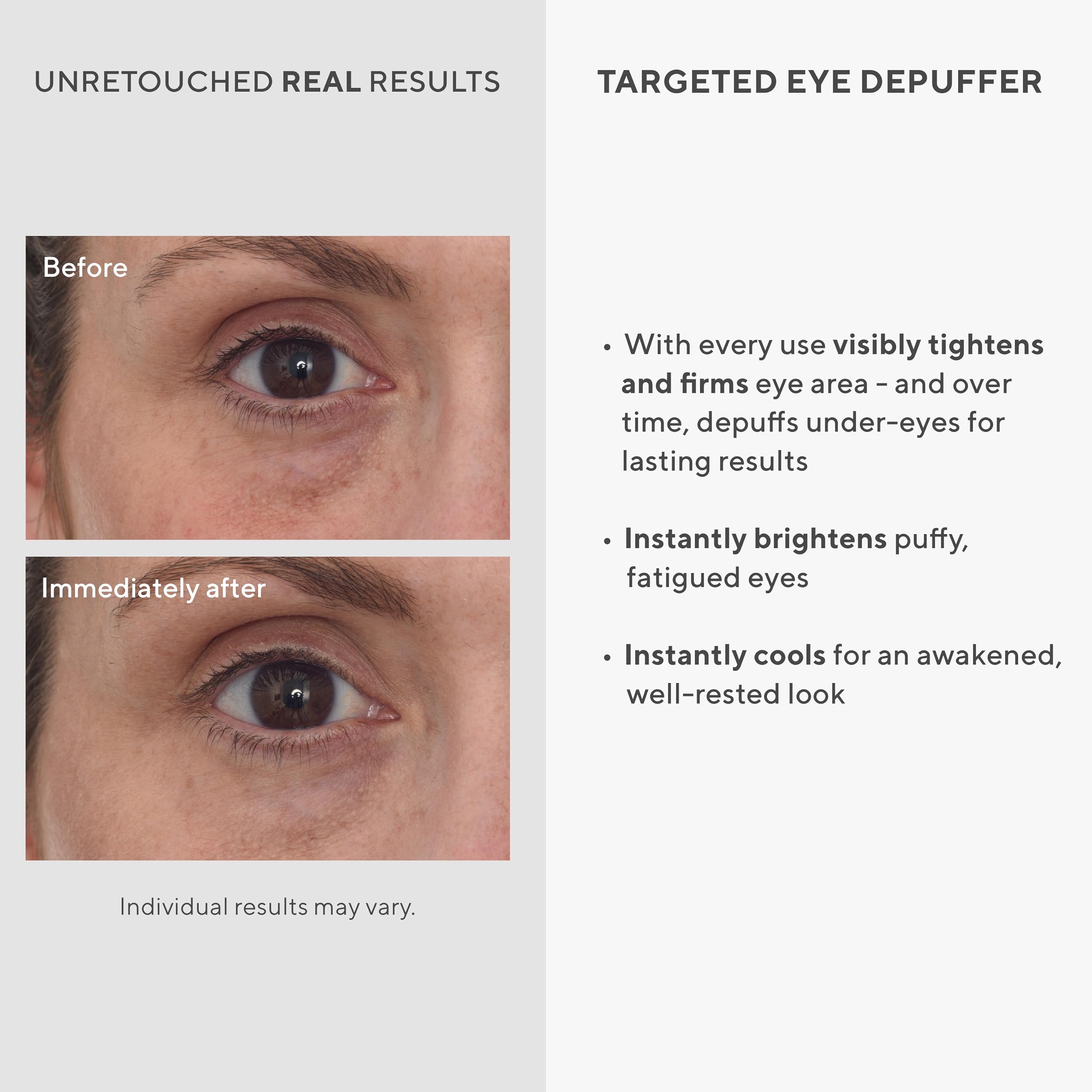 Murad Deshinchador de Ojos Dirigido ilumina la mirada con efecto suave