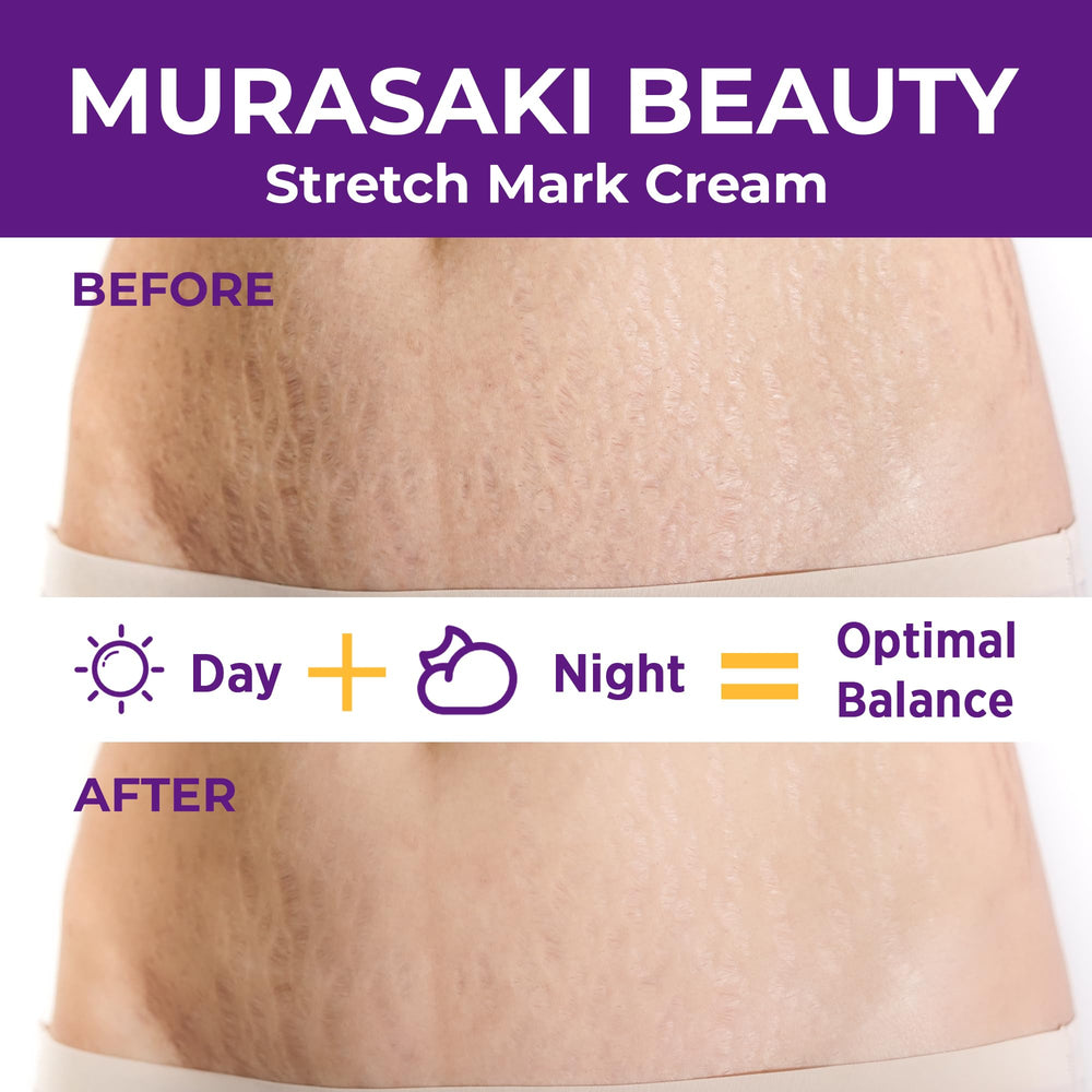 Aplicacion diaria de la crema MURASAKI BEAUTY para embarazo.
