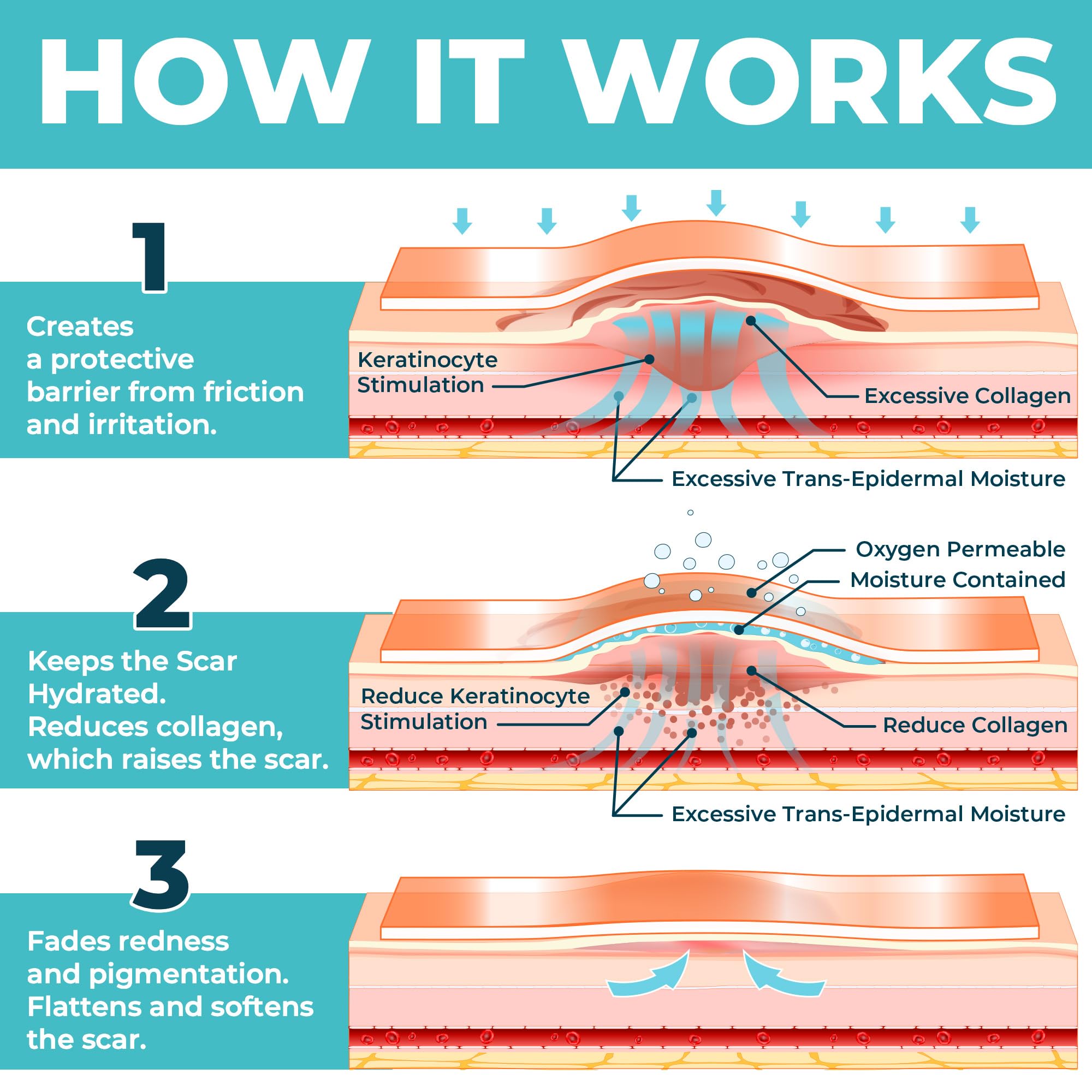 MYHELP tira para rodilla protege la piel y reduce roces.