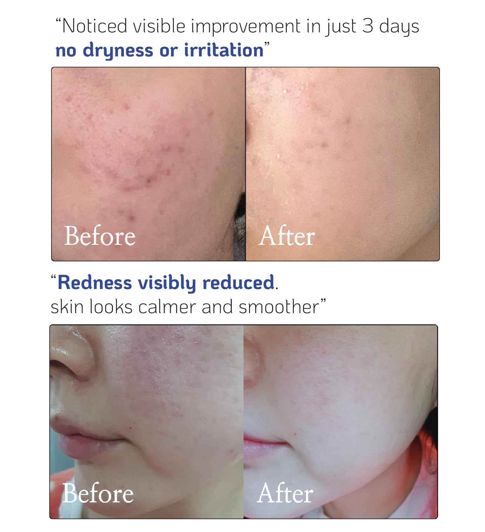 Nano Recipe Ceramida Concentrado: aplicación rápida en el rostro sin sensación grasa.
