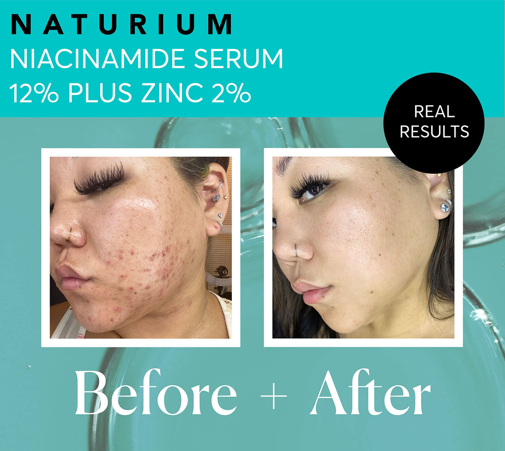 Naturium Niacinamida 12% + Zinc 2% envase libre de crueldad.
