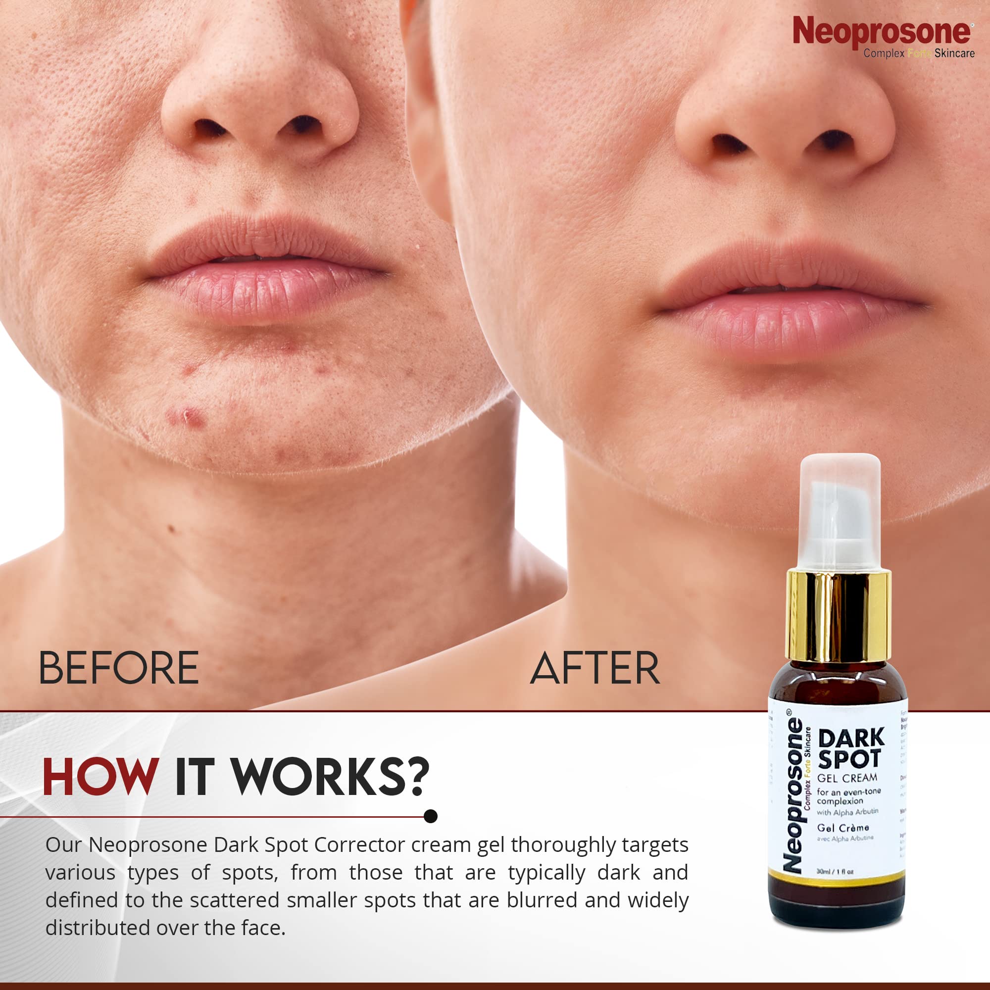 Neoprosone crema para manos, mejora tono uniforme.