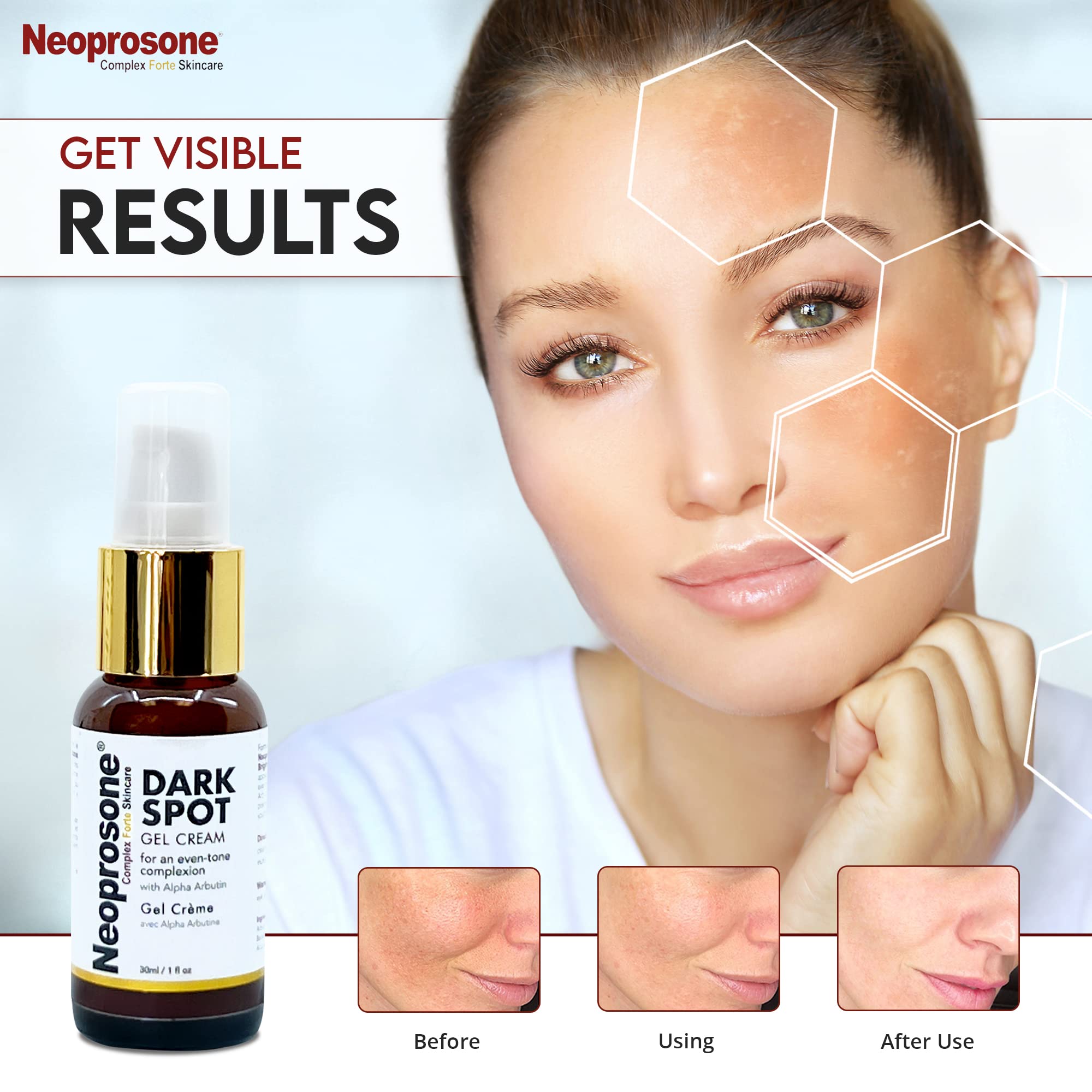 Neoprosone aplicación nocturna para manchas en rostro y cuello.
