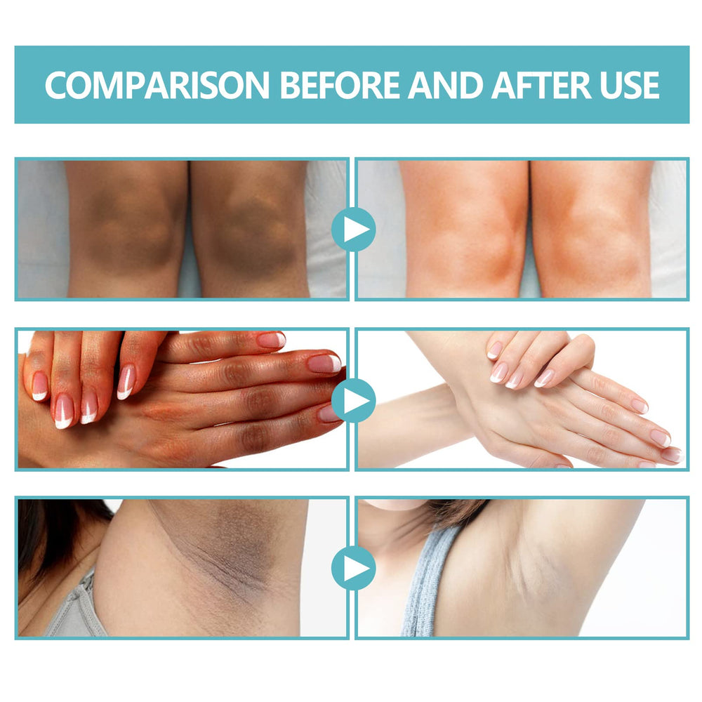 Nigrifix crema: ingredientes clave para nutrir la piel.