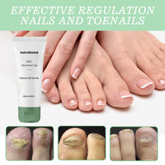 Nutraboost Reparación Uñas: gel que aporta brillo e hidratación.