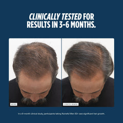Nutrafol Men 50+ capsules poured into a dish for consistent daily use.