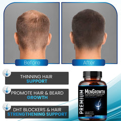 NutraPro Men Growth: barba en crecimiento gracias a la fórmula.