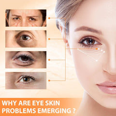 NYYQYYN Revive Glow Ojos: reduce fatiga y suaviza ojeras.