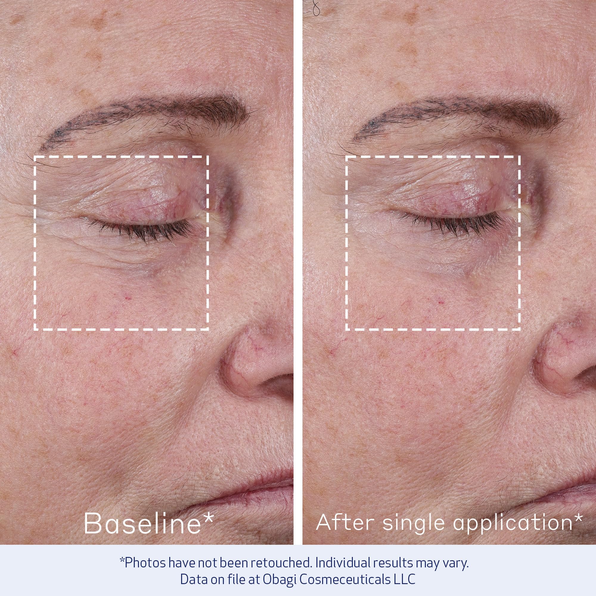 Obagi Elastiderm, primer plano de piel, revela firmeza suave y aspecto más joven.