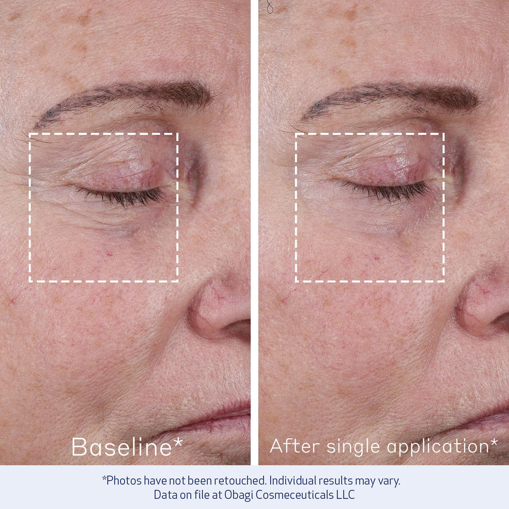 Obagi Elastiderm, primer plano de piel, revela firmeza suave y aspecto más joven.