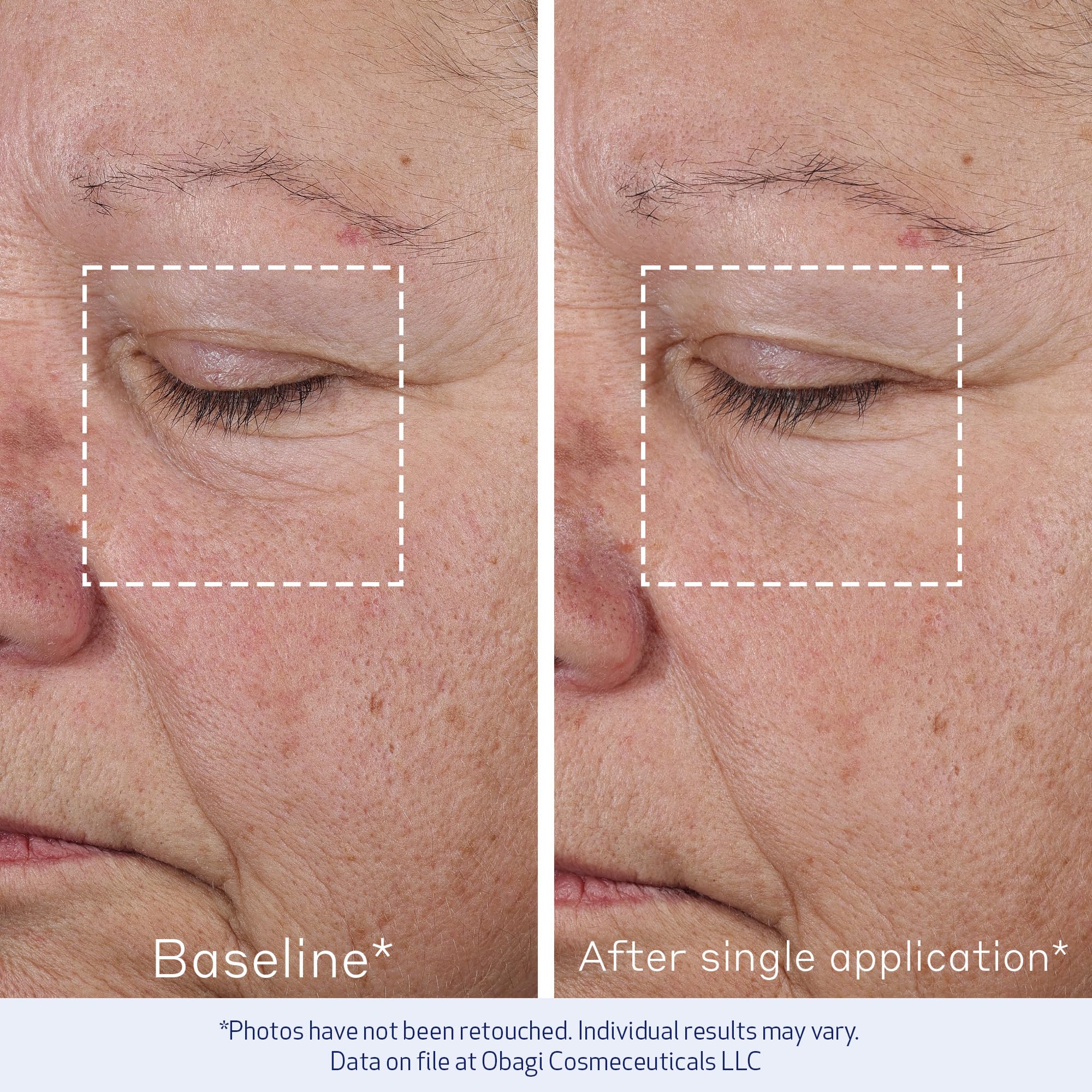 Obagi Elastiderm, textura crema sedosa que suaviza líneas finas al tacto.