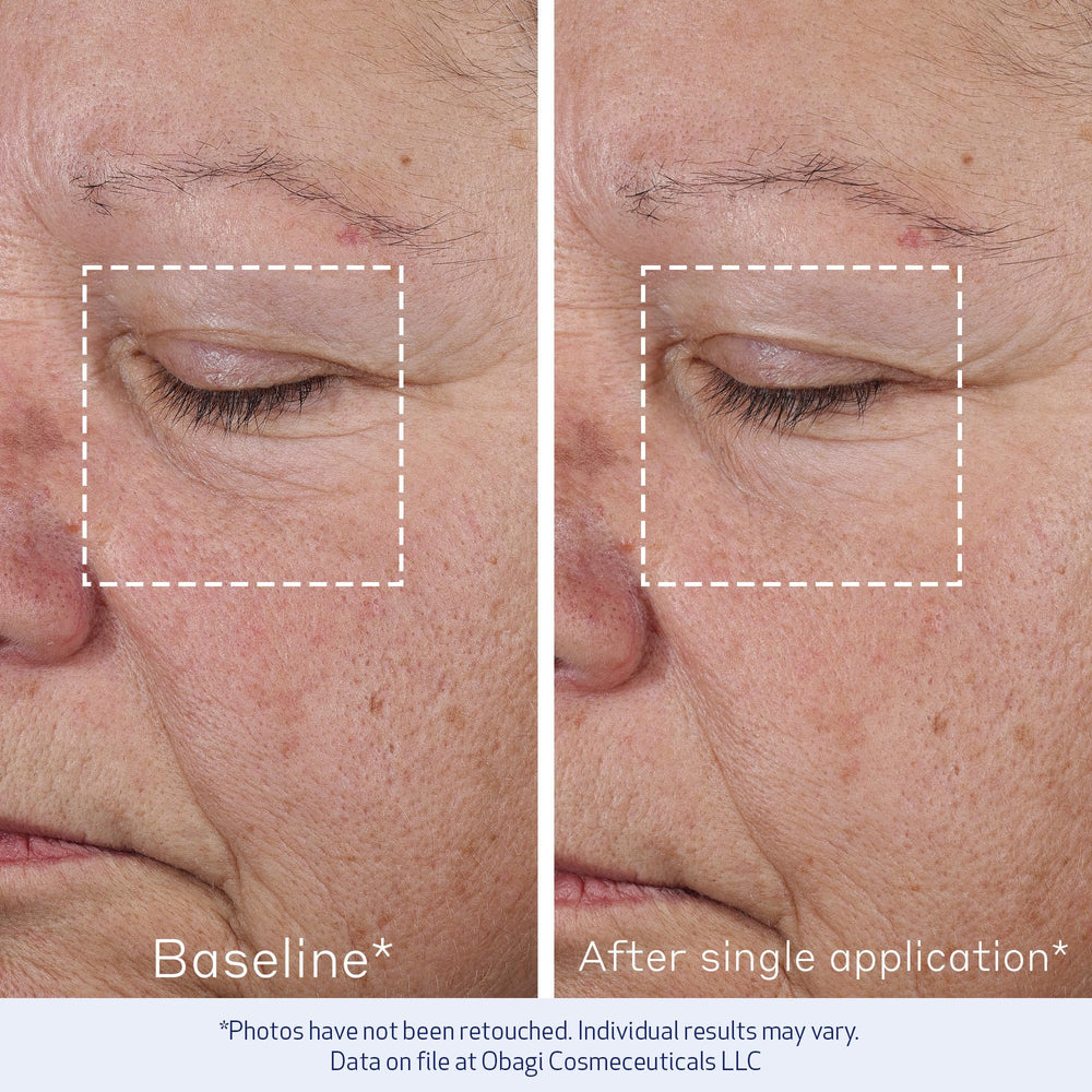 Obagi Elastiderm, textura crema sedosa que suaviza líneas finas al tacto.