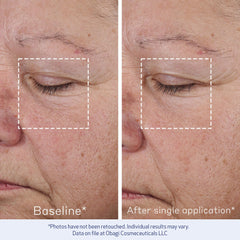 Obagi Elastiderm, textura crema sedosa que suaviza líneas finas al tacto.