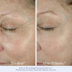 Obagi ELASTIderm Crema de Ojos, aplicación con dedo anular, cuidado delicado.