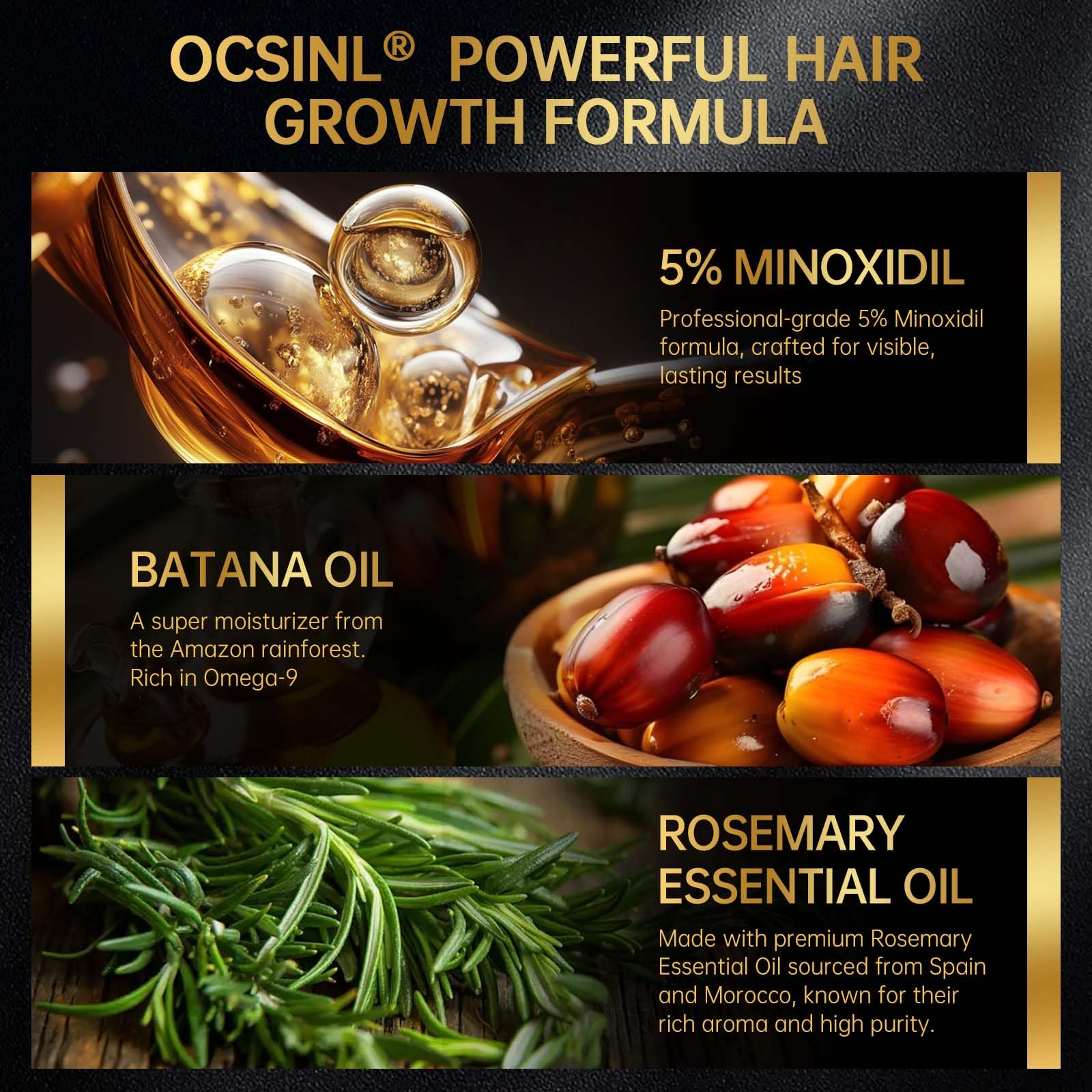 OCSINL Minoxidil aceite esencial romero con aroma suave y cuero cabelludo saludable