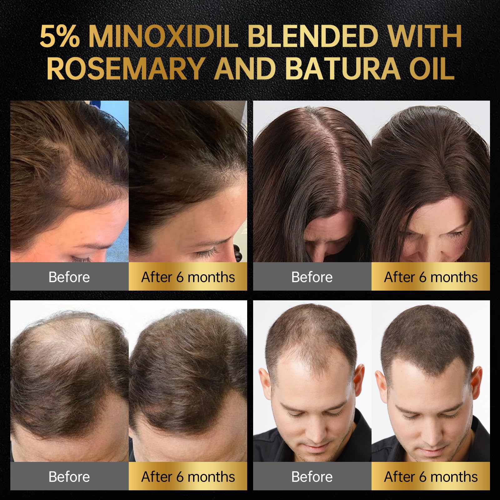 OCSINL Minoxidil aplicador masaje para absorción eficiente en raíces